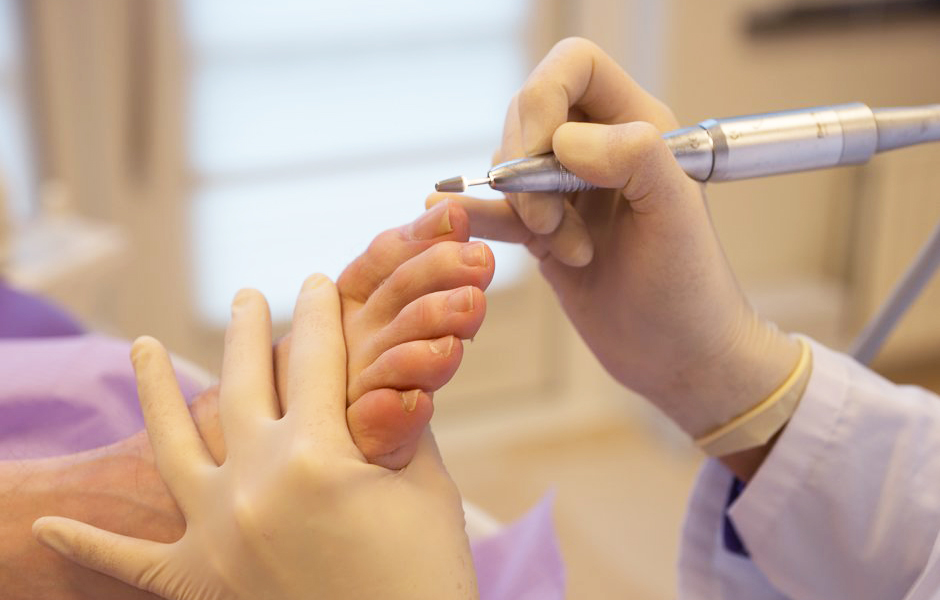 Medische pedicure in Alkmaar